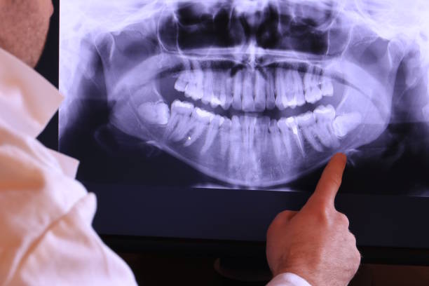 Best Emergency Dental Surgery in Patterson Tract, CA
